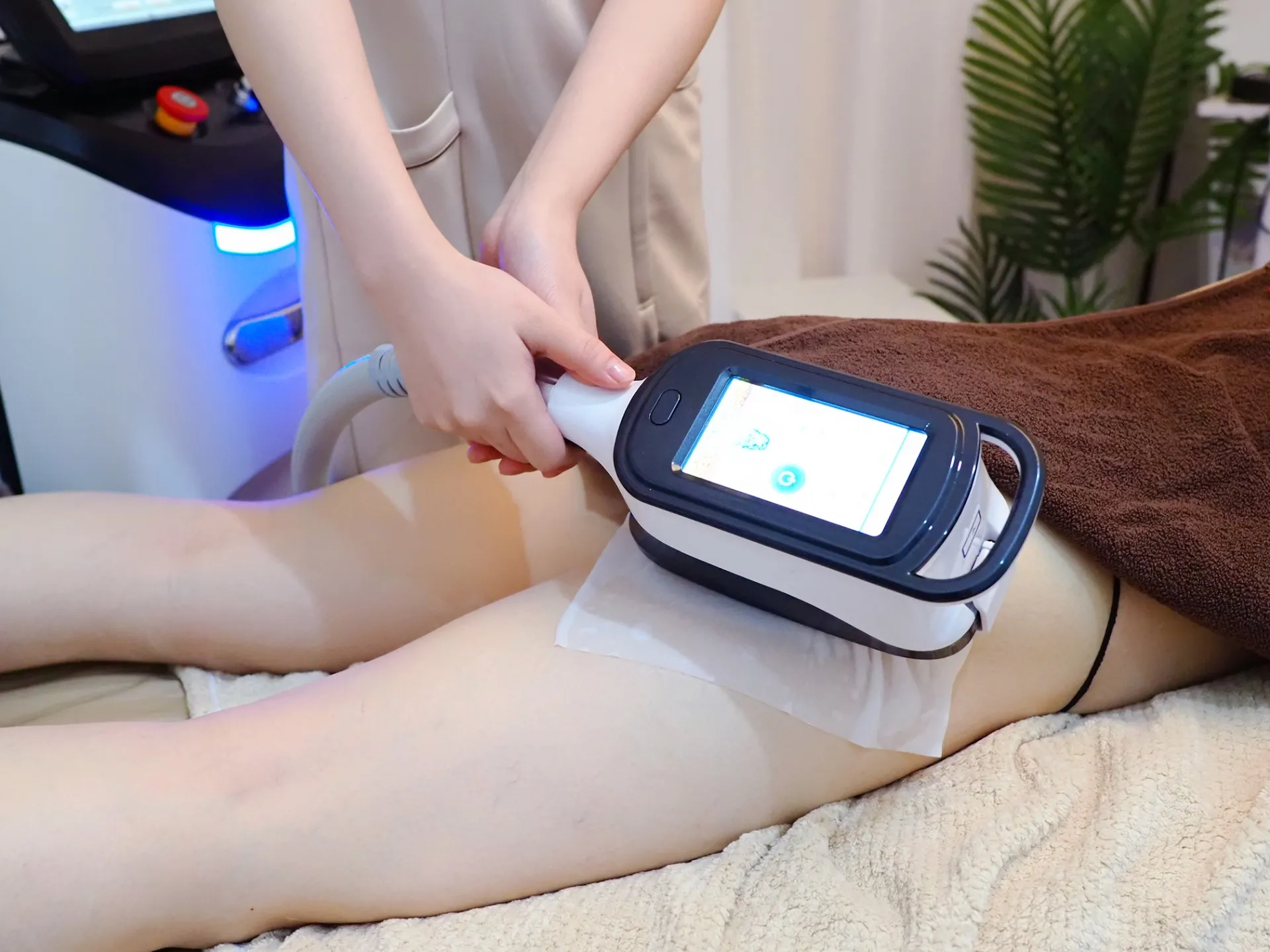 脂肪冷却の下半身の症例写真