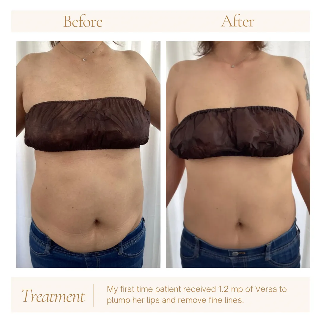 お酒大好きなお客様のお腹痩せ